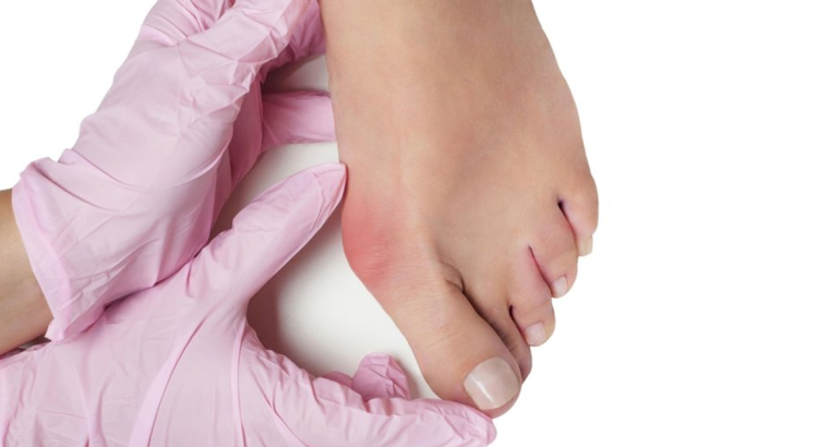 Foot and Ankle Fusion Surgery