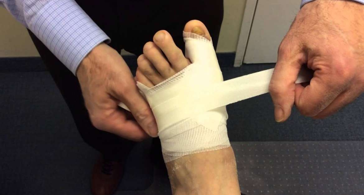 Minimally Invasive (MIS) Foot and Ankle Surgery