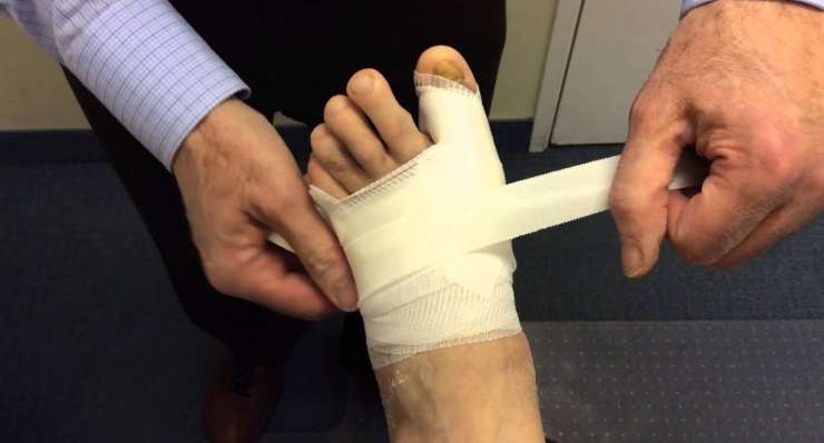 Minimally Invasive (MIS) Foot and Ankle Surgery